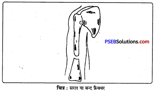 PSEB 9th Class Physical Education Solutions Chapter 4 प्राथमिक सहायता (1)