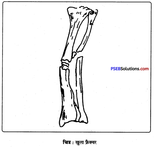 PSEB 9th Class Physical Education Solutions Chapter 4 प्राथमिक सहायता (2)