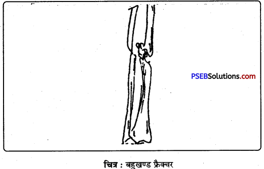 PSEB 9th Class Physical Education Solutions Chapter 4 प्राथमिक सहायता (3)