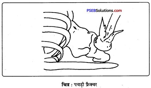 PSEB 9th Class Physical Education Solutions Chapter 4 प्राथमिक सहायता (4)
