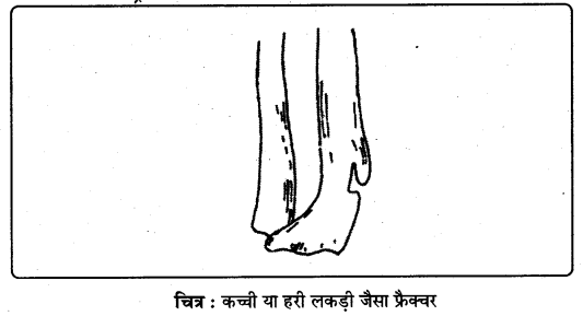 PSEB 9th Class Physical Education Solutions Chapter 4 प्राथमिक सहायता (5)