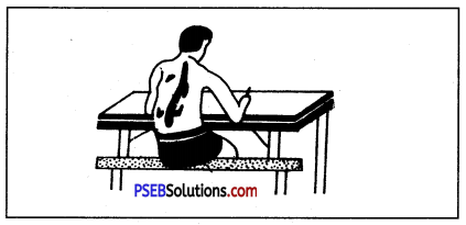PSEB 7th Class Physical Education Solutions Chapter 3 शारीरिक ढांचा और इसकी कुरूपताएं 2