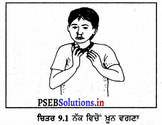 PSEB 8th Class Home Science Solutions Chapter 9 ਮੁੱਢਲੀ ਸਹਾਇਤਾ 1