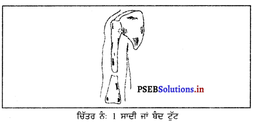 PSEB 9th Class Physical Education Solutions Chapter 4 ਮੁੱਢਲੀ ਸਹਾਇਤਾ 1