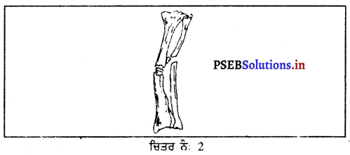 PSEB 9th Class Physical Education Solutions Chapter 4 ਮੁੱਢਲੀ ਸਹਾਇਤਾ 2