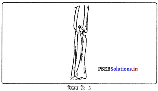 PSEB 9th Class Physical Education Solutions Chapter 4 ਮੁੱਢਲੀ ਸਹਾਇਤਾ 3