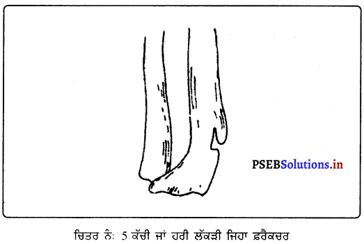 PSEB 9th Class Physical Education Solutions Chapter 4 ਮੁੱਢਲੀ ਸਹਾਇਤਾ 5